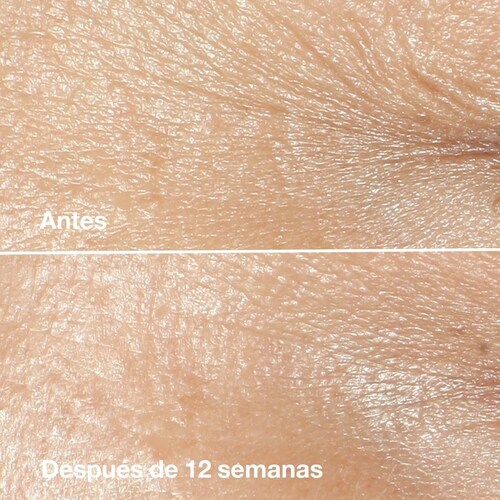 Crema Antierrugas Clinique Smart Clinical Repair Wrinkle 50Ml