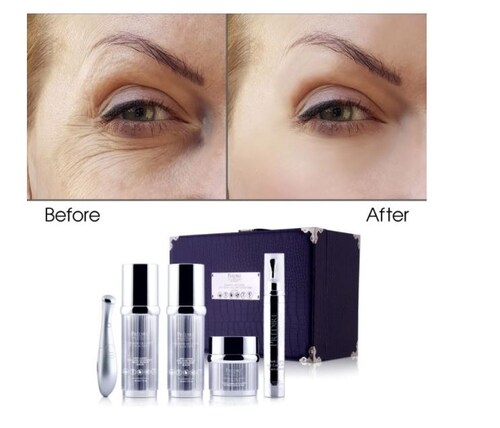 Kit Contorno De Ojos Lifting, Gel, Suero Día Y Noche Prédiré
