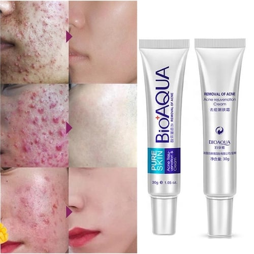 Crema Anti Acne Bioaqua Pure Skin Cicatrices Control Grasa Anti Acne Bioaqua Pure Skin Cicatrices Control Grasa