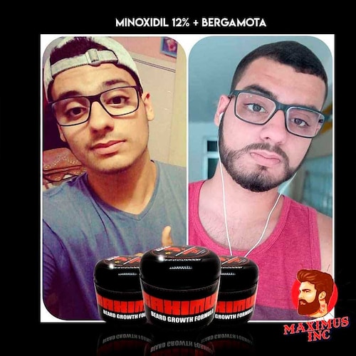 Bálsamo de minoxidil al 12% 4 oz Crecimiento de Barba y Bigote cerrar huecos | Haz crecer tu barba | Tapa huecos Sin tapar poros 