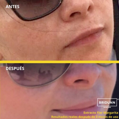Crema Despigmentante Facial Aclaradora, Quita Manchas Y Paño Bridunn Skincare
