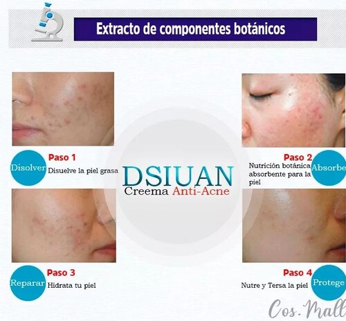 Crema Natural Portulaca Anti Acne Puntos Negros Espinillas 100 mL