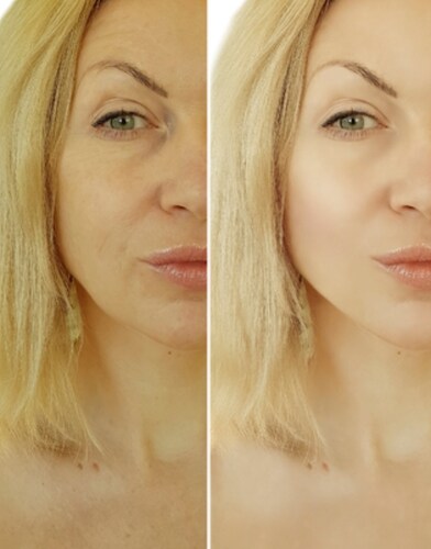 Gel nutri-restaurador piel grasa. biobelleza  Elimina líneas de expreción 