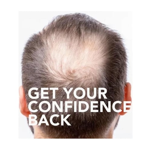 Minoxidil 5% Members Mark Topica 6 Meses Liquido 60ml 6 Pack 