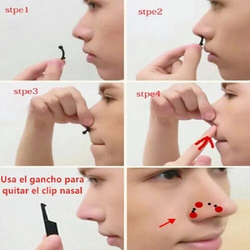 6 Pares Corrector Nasal Respigador Nariz