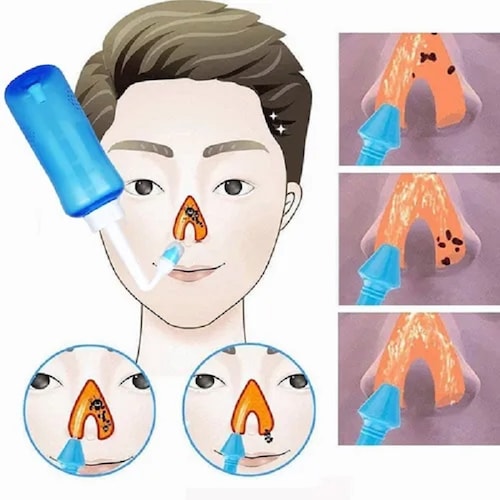 Frasco De Lavado Nasal 500ml 