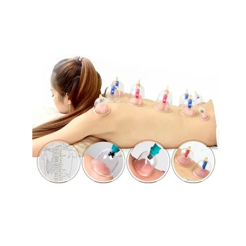 Kit 12 Ventosas Relajacion Adelgazamiento Terapeuticas 
