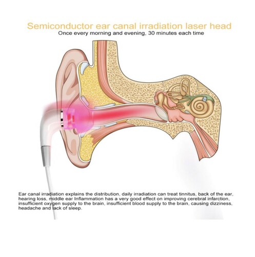 Terapia Laser Tinnitus Oidos Sordera Zumbido Oido Nadador
