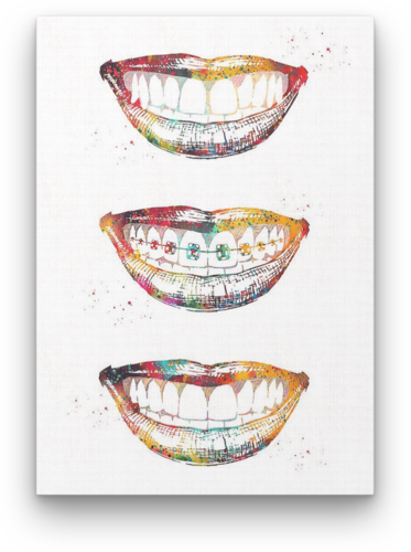 Cuadro Decorativo Arte Dental Consultorio Dentista Efecto Acuarela 28x41cm 