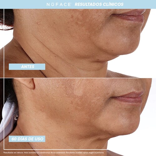 Dispositivo de Microcorriente NuFACE MINI+® Midnight black | Skin Care Mujer