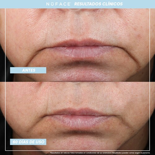 Kit NuFACE FIX "Platinum" y MINI+ Sandy Rose