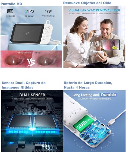 Video Otoscopio Teslong MS500 con Pantalla HD