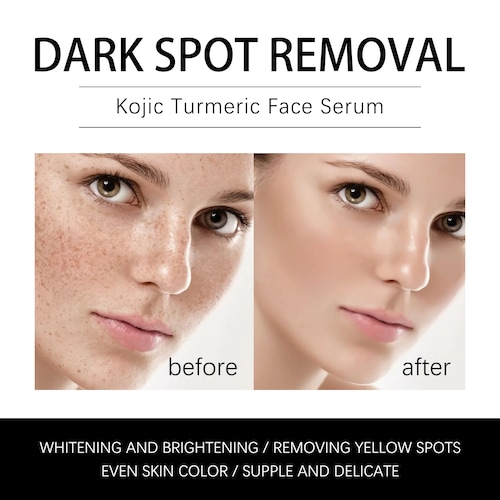 Serum blanqueador de pecas, elimina  manchas oscuras JAYSUING.