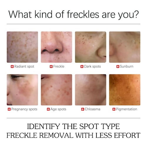 Serum blanqueador de pecas, elimina  manchas oscuras JAYSUING.