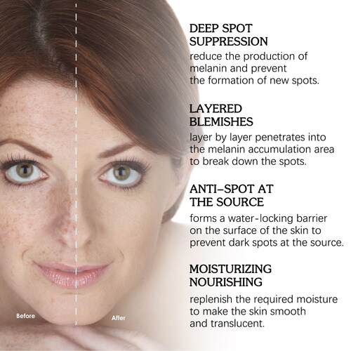 Serum blanqueador de pecas, elimina  manchas oscuras JAYSUING.