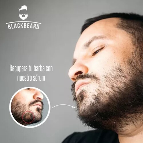 Tónico Crecimiento Barba Blackbeard Minoxidil 2 Meses.