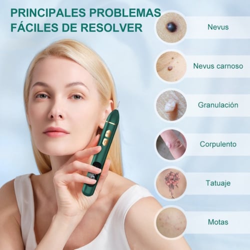 Pluma Quita Verrugas Removedor De Verrugas Manchas Verde