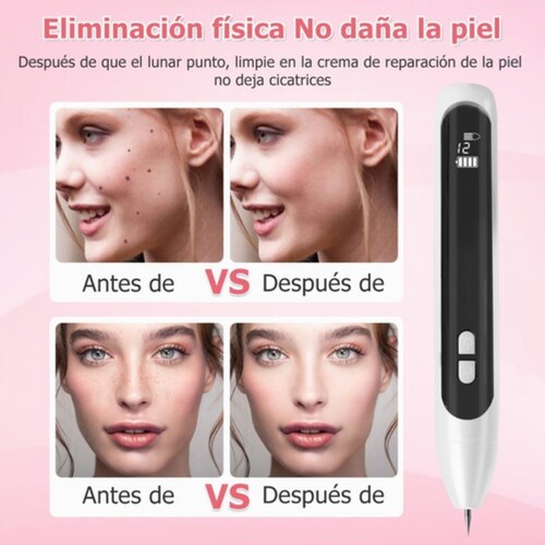 Pluma Cauterizador Quita Verrugas 9 En 1 Manchas Laser blanco/negro