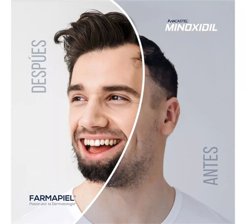 3 Piezas De Minoxidil 5% Para 3 Meses Envío Gratis Anacastel.