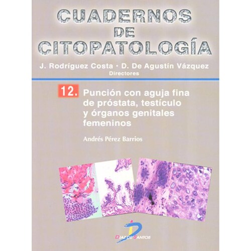 Punción con aguja fina de próstata, testículo y órganos genitales femeninos 