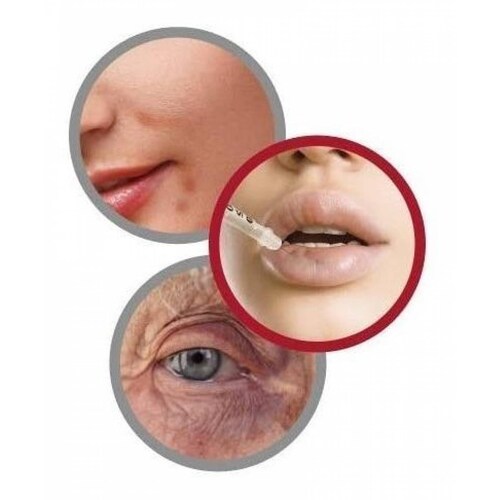 Hematix Gel 30g Desvanecedor De Moretones, Hematomas, Piel 