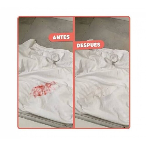 Kit 4pz Quitamanchas Bye Bye Manchas Drops Quita Manchas de Textil