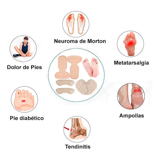 MADIOLA Kit de Almohadillas para Pie Amortiguantes, Alivio Dolor en el Antepié, Prevencion Callos y Ampollas Juanetes Salud Pies Cuidado Pies