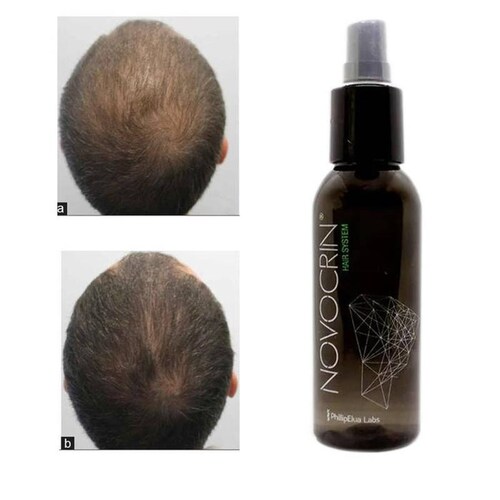 Locion Anticaida del Cabello MXLTG-001-6 1 Pza 100ml Loción Unisex Botella con Atomizador Uso Diario, LotionGrow