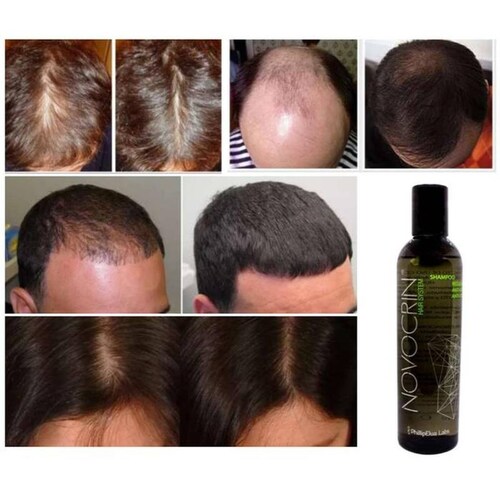 Shampoo capilar para caida Hombre MXSHW-003-4 3 Pza 250ml Shampoo Unisex 100porciento Natural Botella Plástico Uso Diario, ShampGrow