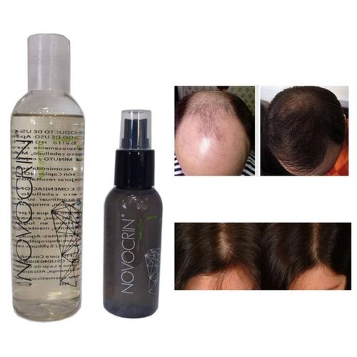 Paquete de Limpieza Capilar MXHGO-002-6 2xShampoo 250ml 2xLocion 100ml Unisex Botella de Plástico Uso Diario HairGrowth