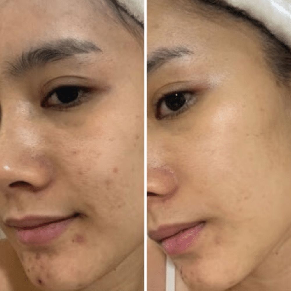 Pack 2 Jabones de Thanaka 50g. Controla y Elimina la Aparición de Acné y Manchas. Nutre y da Vitalidad.