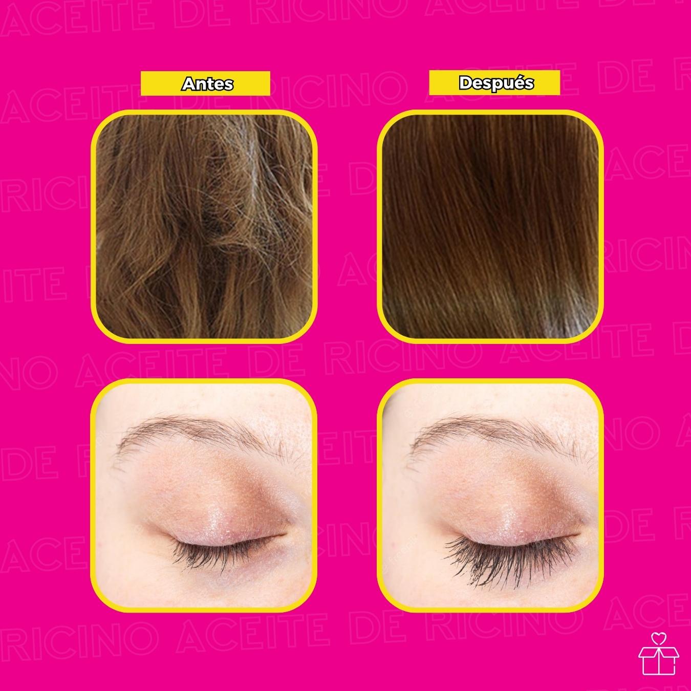 Aceite De Ricino Orgánico Crecimiento De Cabello