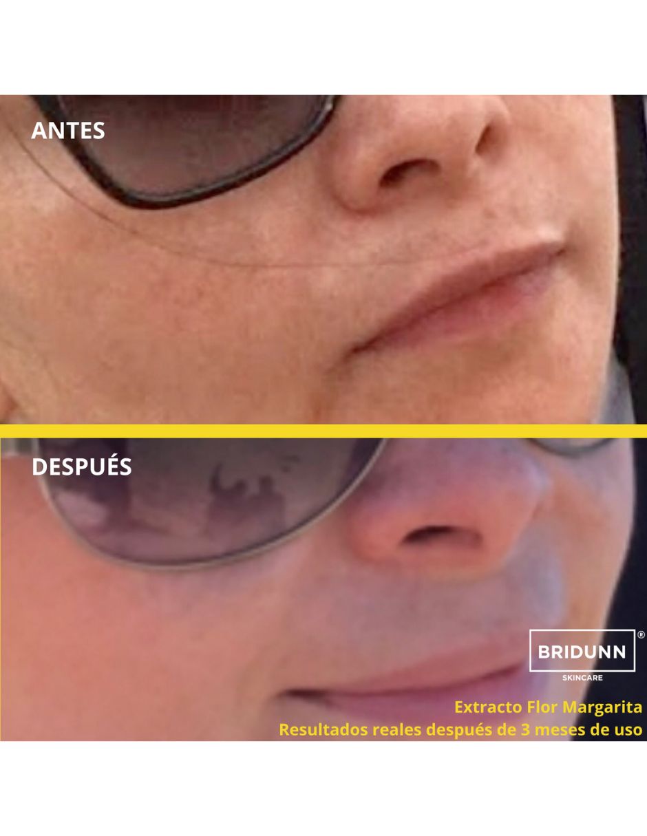 Crema Facial Despigmentante Correctora De Manchas Oscuras Y Solares Bridunn Skincare.