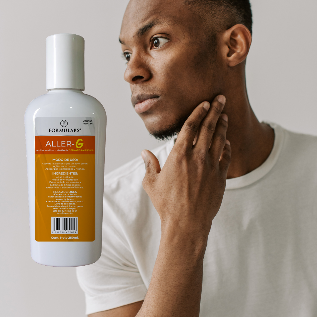 Crema para Dermatitis Alérgica, Repara, Calma y Mejora la apariencia. 30g Aller G- Formulabs