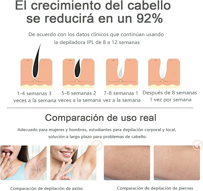A Yostyle IPL Depiladora de Luz Pulsada, Flashes Depilación Láser para Mujeres, 5 Nivel de Energía, Sistemas de Depilación Dispositivo Profesional Indolora, para Piernas, Cara, Cuerpo, Línea de Bikini.