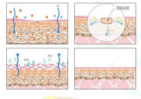 Gel Crema Reductiv Reafirmante Combate Y Elimina La Celulitis Estrias 3-1 Quema Grasa Pegada Artesanal 