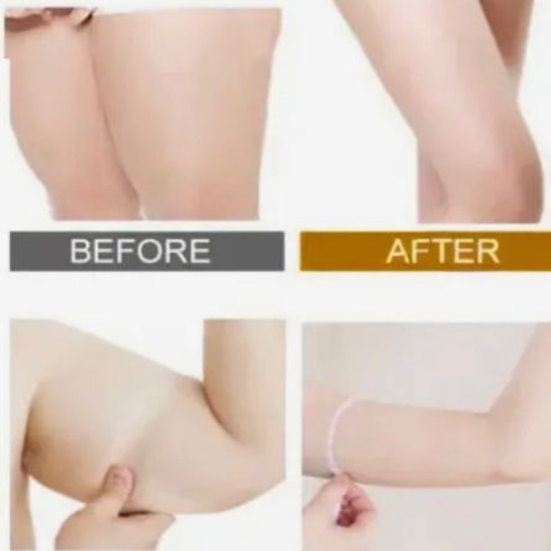 Gel Crema Reductiv Reafirmante Combate Y Elimina La Celulitis Estrias 3-1 Quema Grasa Pegada Artesanal 