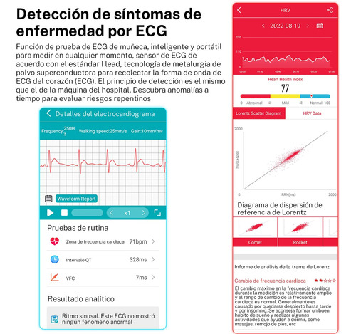 Reloj Inteligente Para Medir La Ritmo Cardiaco Y La Glucos.
