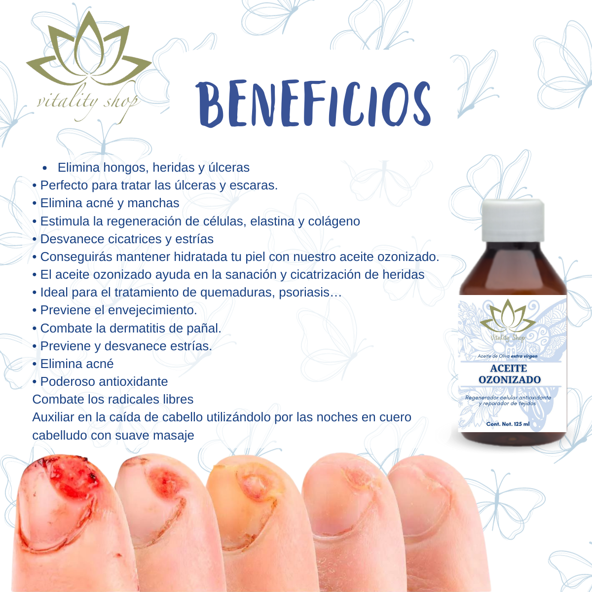 Aceite Ozonizado Antioxidante Regenerador Elimina Manchas 125ML