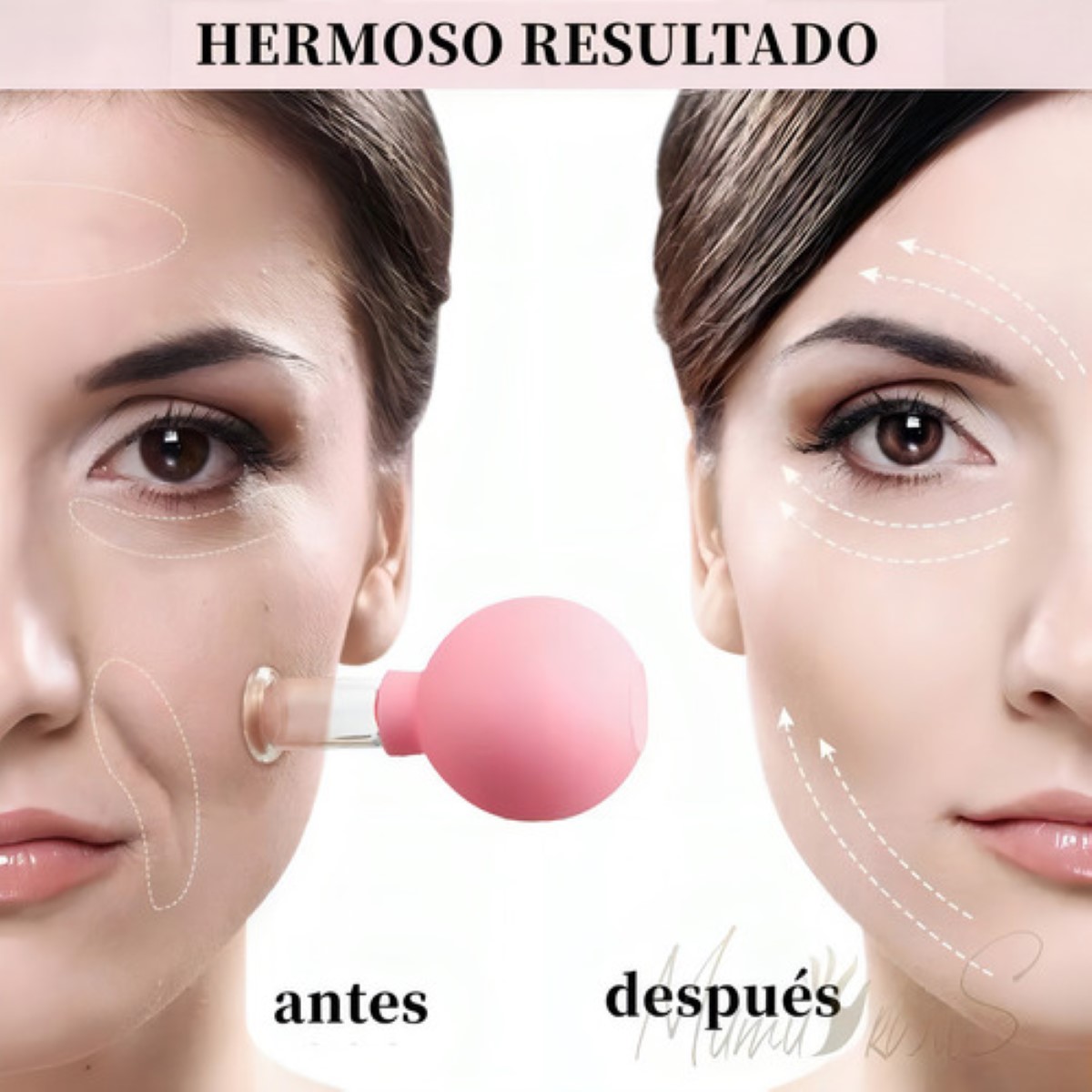 Ventosas Terapeuticas Facial Cuerpo Masaje Anticelulitis Set Rosas