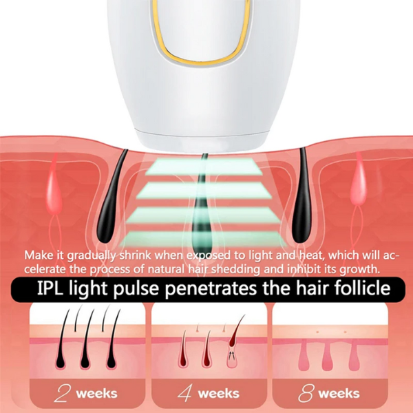 Depiladora Laser, Dispositivo de depilación láser IPL para Mujeres y Hombres, depiladora eléctrica para Bikini, Pierna, Brazo entre otros, indolora, uso doméstico