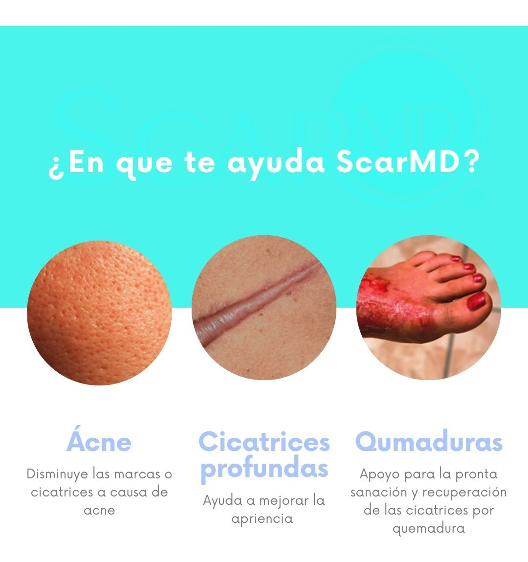 Scar Md Glide Gel, Masaje, Desvanece Cicatrices, Silicona