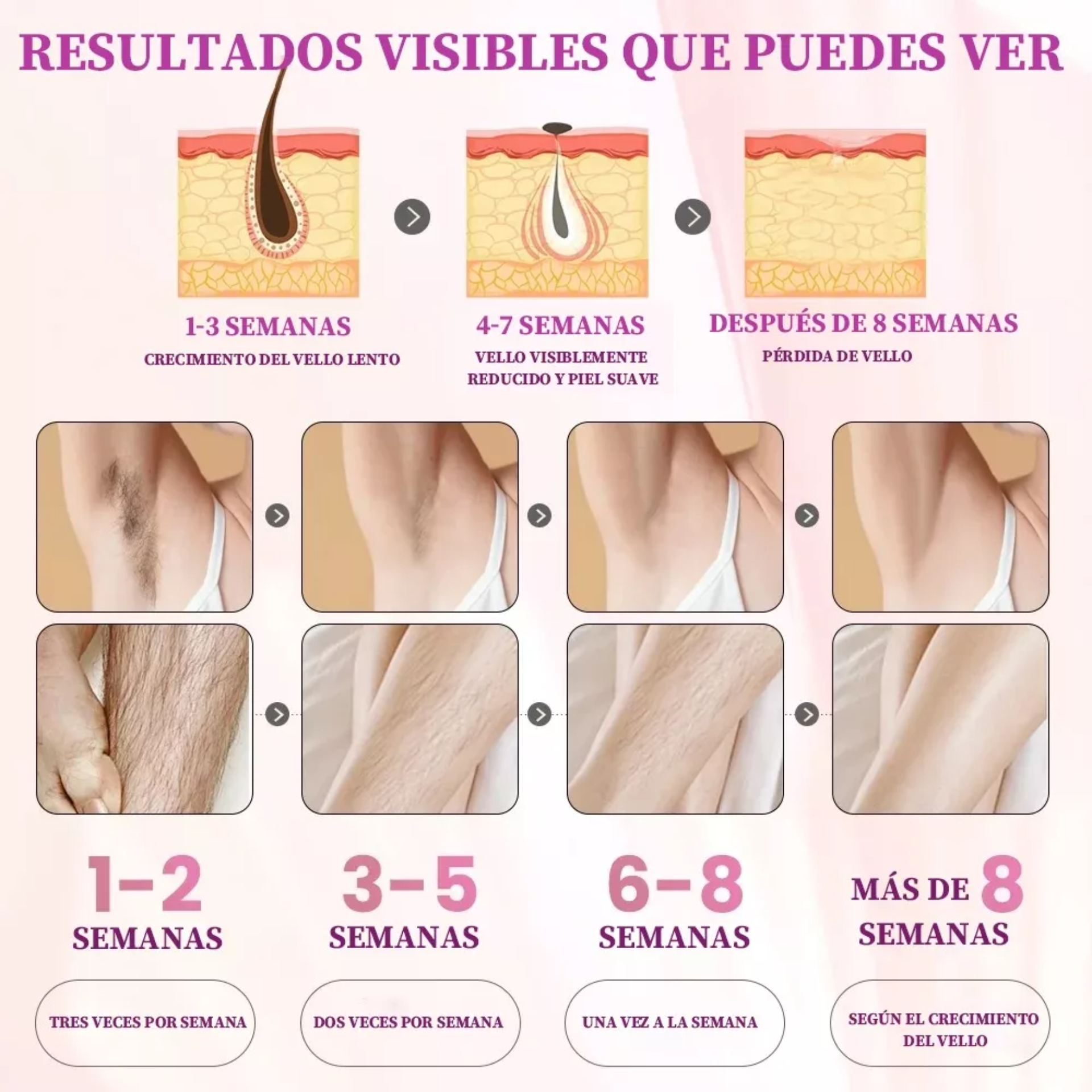 O F E R TA  Ipl Depiladora Láser Permanente Sin Dolor Para Todo El Cuerp