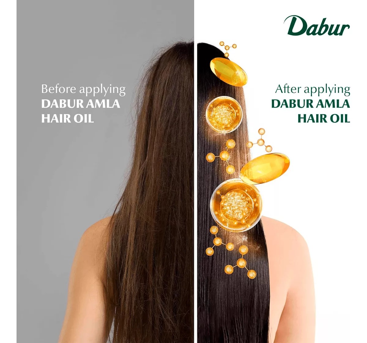 Dabur Aceite De Amla Para Cabello - Amla Hair Oil 300ml Aceite Nutritivo e Hidratador 