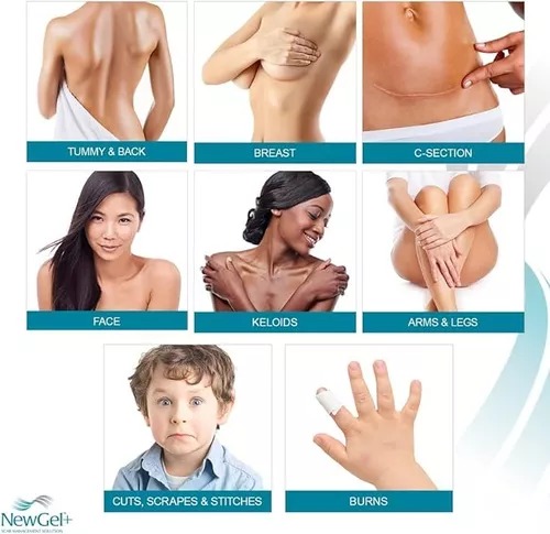Gel Cicatrizante Con Vitamina E New Gel Avanzado Cicatrices 30 g