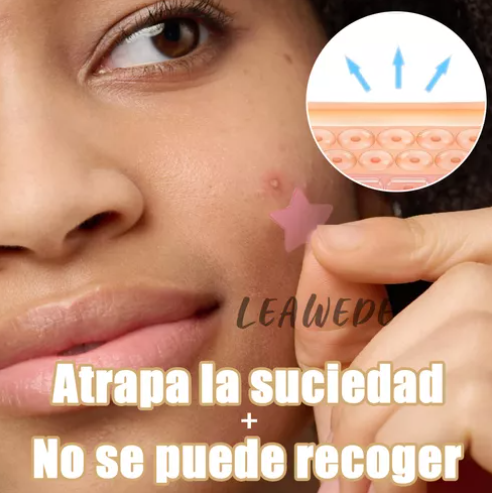 240pzs Mascarillas Estrella Para El Acne Espinillas Granos