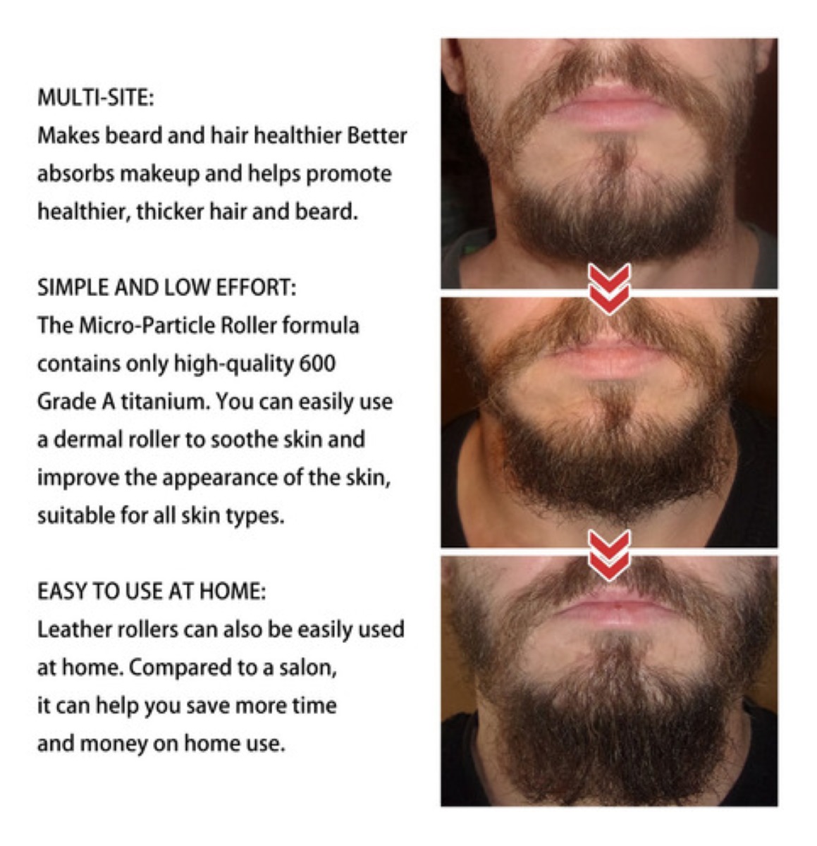 Derma Roller 0.5 Mm Para Barba Y Facial Cabello NEGRO