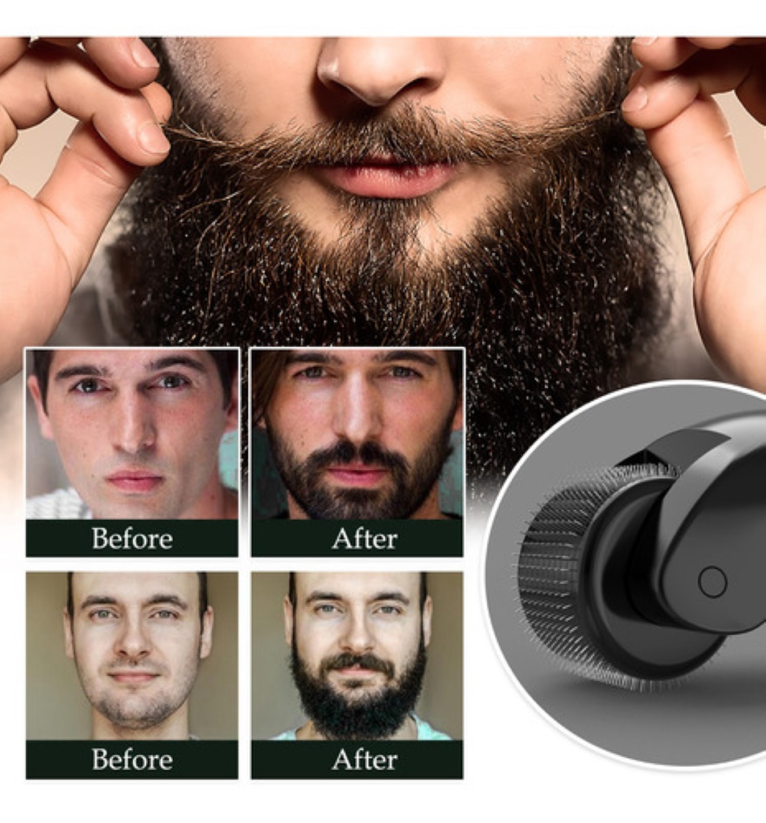 Derma Roller 0.5 Mm Para Barba Y Facial Cabello NEGRO