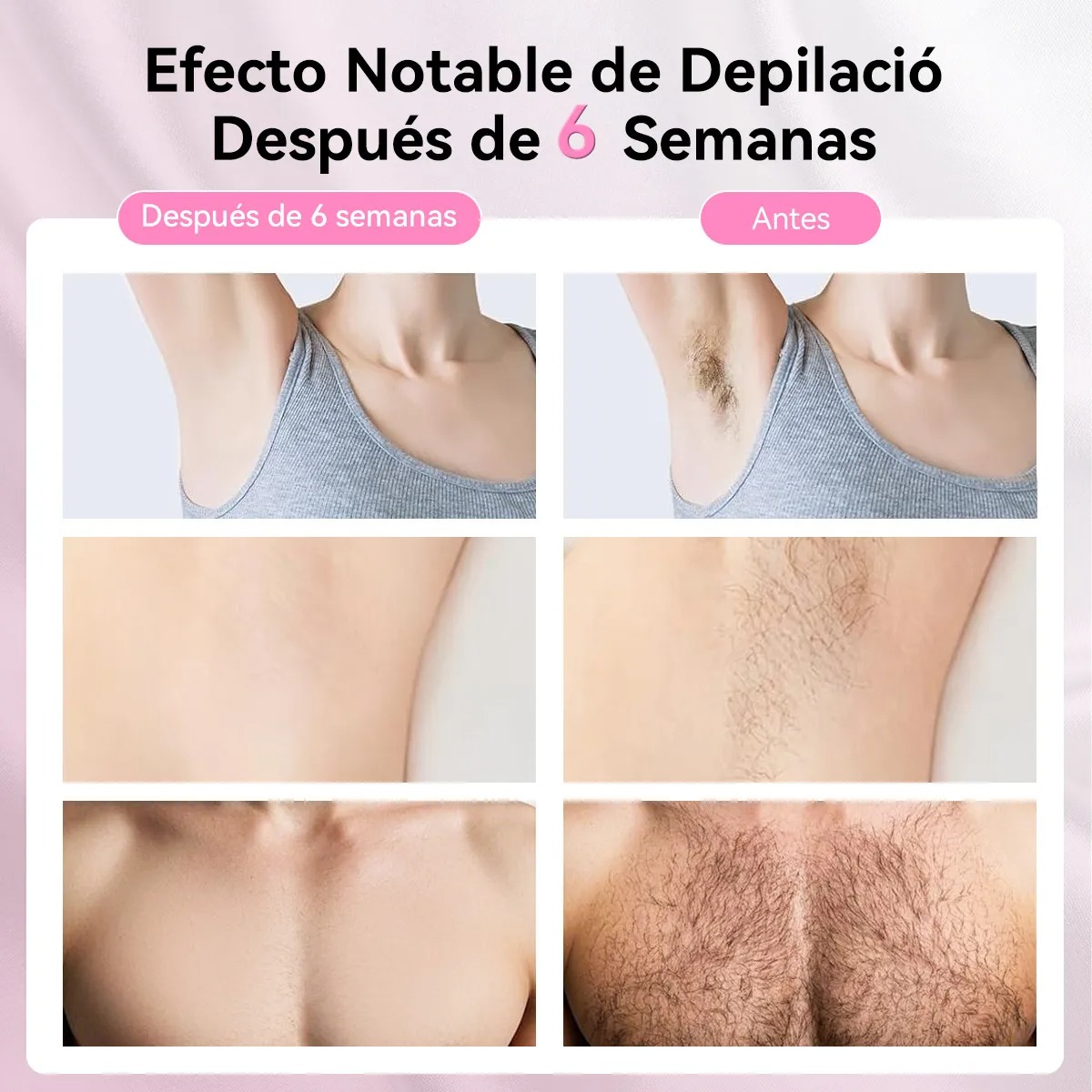 Superflash Láser Depiladora Ipl Pulsada Permanente Para Cuerpo Y Cara Rosa Maquina Depiladora Laser Profesional Maquina Depilacion Definitiva Soprano Aparato Depilacion laser Ipl 127V