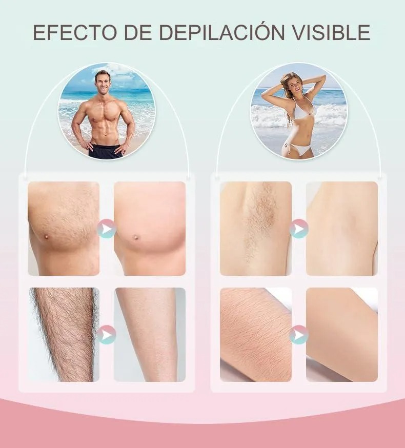 Babeefly Depiladora Permanente Láser 999,999 Flashes Facial Y Corpora Sin Dolor Depiladora Profesional Permanente De Ipl 110v/220v Blanco Depiladora Láser Permanente De Luz Pulsada Lpl Sin Dolor